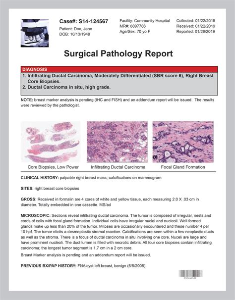 Pathology Report After Surgery .